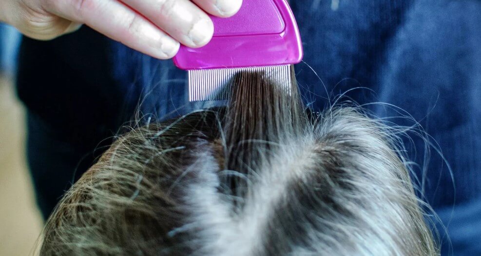 Treating Head Lice, Suggested Remedies for Getting Rid Headlice